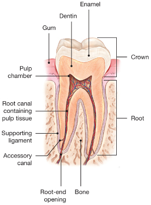 root canal